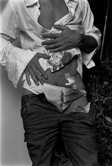 Autorretrato con el cuerpo herido